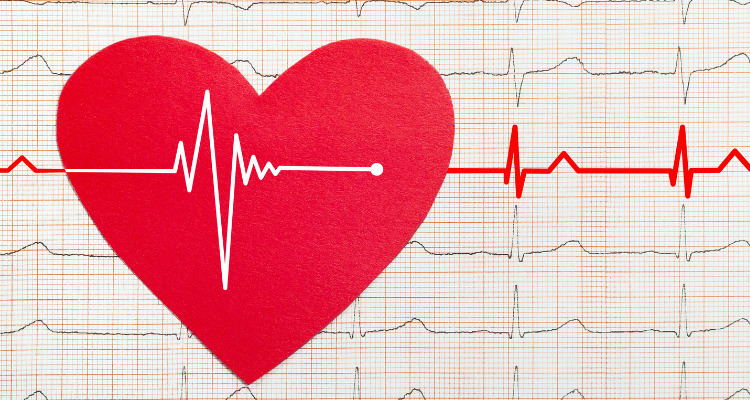 心電図のイメージ