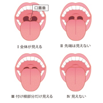 舌マランパチ－分類